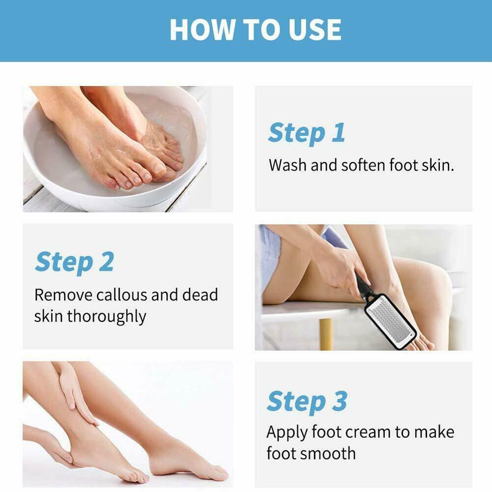 "Professional Foot Callus Remover & Pedicure Tool"