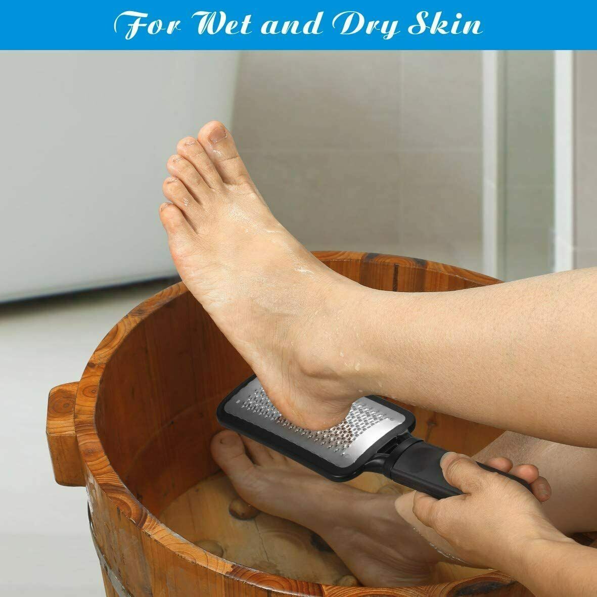 "Professional Foot Callus Remover & Pedicure Tool"