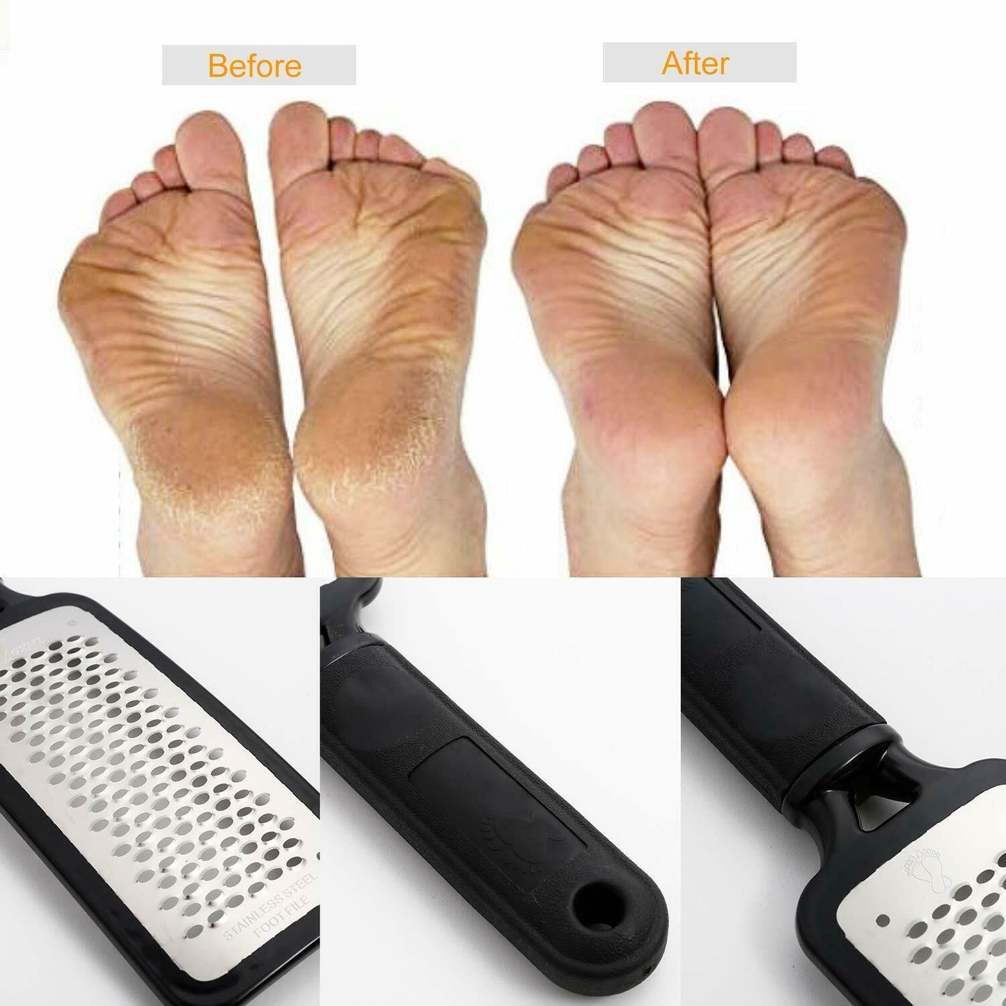 "Professional Foot Callus Remover & Pedicure Tool"