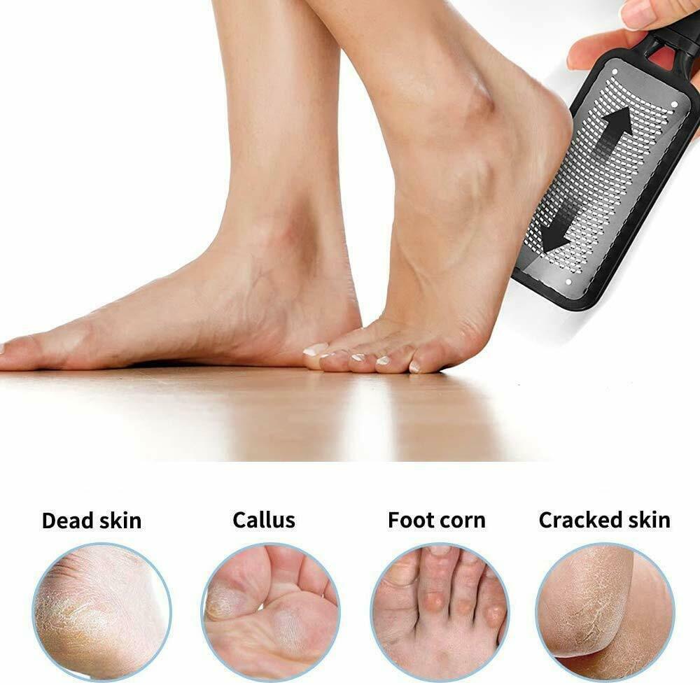 "Professional Foot Callus Remover & Pedicure Tool"