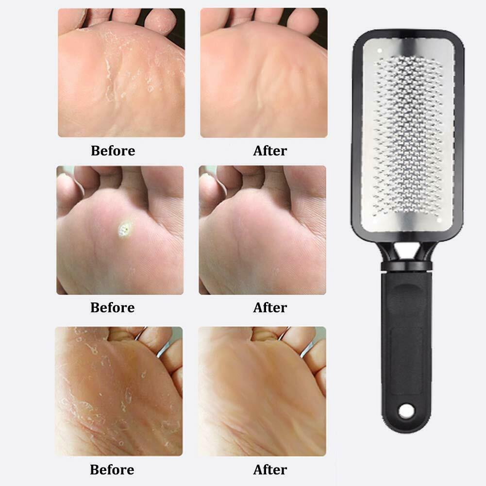 "Professional Foot Callus Remover & Pedicure Tool"